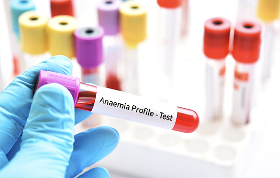 Anemia Profile