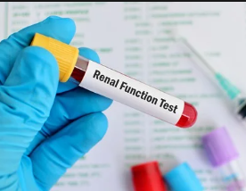 Kidney / Renal Profile