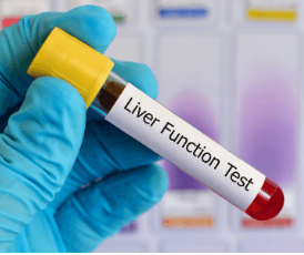Liver Profile