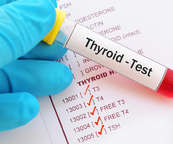 Thyroid Function